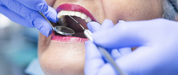 Best Knocked-Out Tooth (Avulsed Tooth) Treatment in Aloha, OR